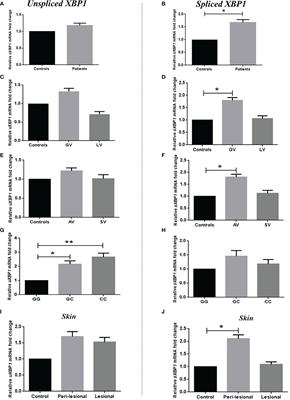 Elevated X-Box Binding Protein1 Splicing and Interleukin-17A Expression Are Associated With Active Generalized Vitiligo in Gujarat Population